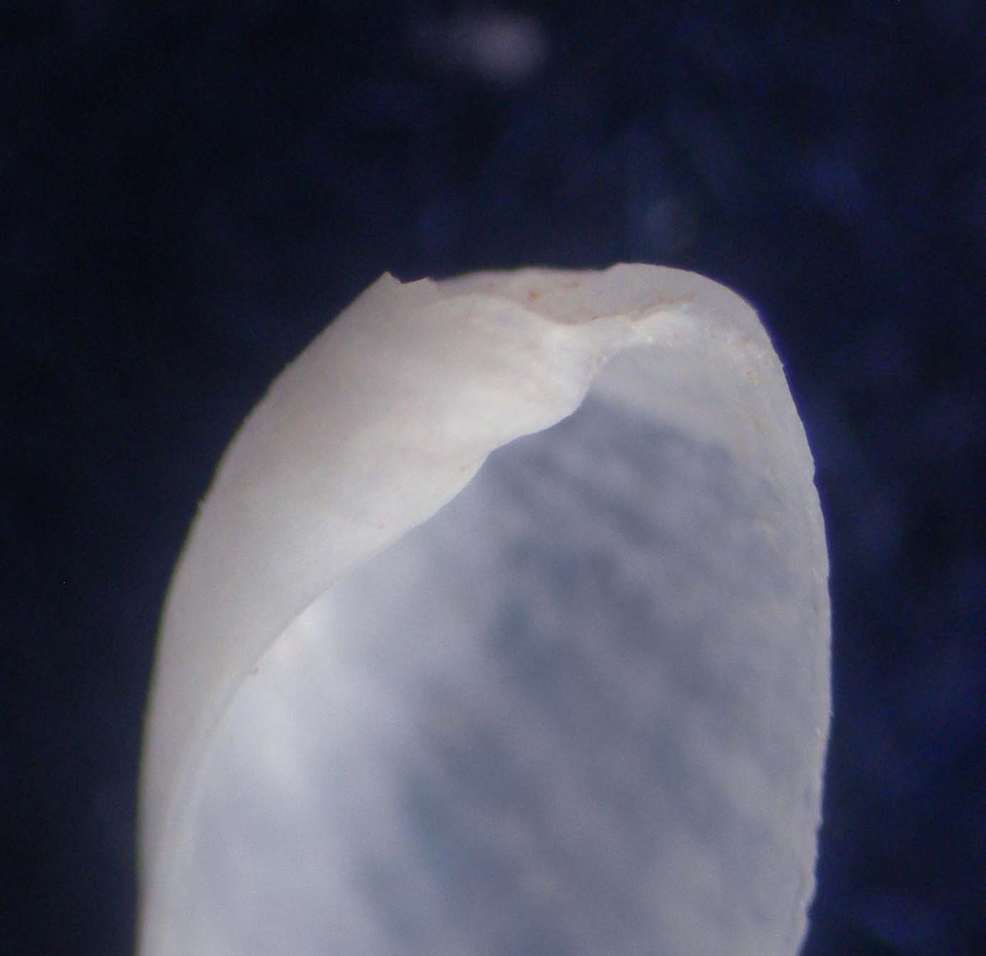 philine denticulata???